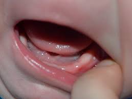 Check spelling or type a new query. Rthsp64djns3pm