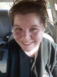 Great Dane causes head cold and concussion to owner