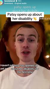 Patsy Field Love Island Disability