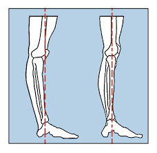 An injury such as a fracture may cause sudden, severe pain. Blog Musicians Health Collective