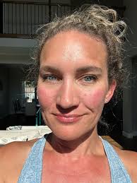 Lyme disease diagnosis and treatment for autoimmune disease patients