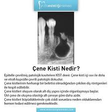 Cene Kisti Nedir Www Disestetigimerkezi Com