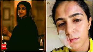 Malayalam TV actress Jaseela Parveen alleges physical abuse by her  ex-boyfriend, says, He kicked me on the stomach, punched my face causing a  facial tear | - The Times of India