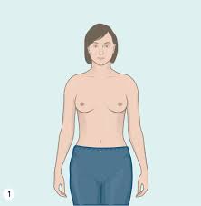 While it may occur due to other causes, skin irritation or dimpling can be related to inflammatory breast cancer (ibc), a rare but aggressive type of the condition. Breast Health Fact Sheet Westmead Bci