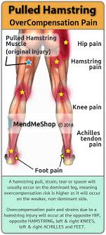 One of the major signs that you may have injured your hamstring would include localized pain in the hamstring area. Hamstring Injury Information And Treatments