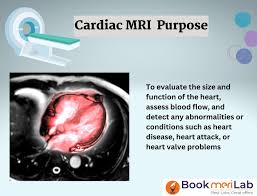 Image result for Cardiac MRI