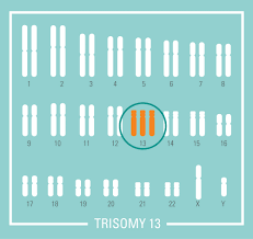 Dna analysis os answer key : Harmony Test Non Invasive Prenatal Test Nipt Clinical Labs