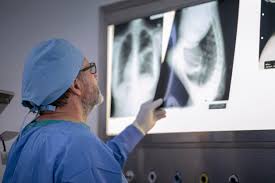 See more ideas about rib cage, human anatomy, anatomy. When Should I Be Concerned About Rib Pain