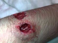Federal american eagle lake city 50cal bmg 690gr 50rds m33. 10 Gunshot Wound Ideas Gunshot Bullet Tattoo Bullet Holes