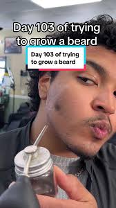 Beard Growth Journey: Minoxidil, Beard Oil, and Routine Tips
