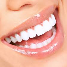 Fastbraces is as comfortable as regular braces and it takes half the time to treat a patient. Hollywood Smile Metal Ceramic One Jaw Belgrade Dental House 041500013 Booking Dentist