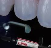 🎨 🎨 These new shades brighten teeth and add depth and vitality by  mimicking enamel's opalescent effects. Get your hands on Renamel® OPALITE™  Microfill and Renamel OPAL™ Flowable Microfill by clicking ...