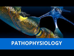 Pathophysiology Of Guillain Barre Syndrome Youtube
