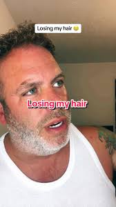 A big part of me is begging to get my hair done to stop me feeling so down  about it. #fyp #losingmyhair #hairtransplant