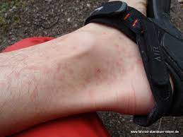 Midges in scotland have a reputation which far outweighs their size, but perhaps not their numbers. Moskitonetz Welches Muckennetz Fur Urlaub Und Reise Worauf Achten