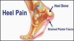 Kenapa tumit kaki sering sakit saat bangun tidur ? Punca Sakit Tumit Kaki Sakit Foot Care Penjagaan Kaki Facebook