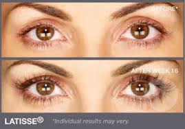 It is best to use latisse every night. Latisse Washington Institute