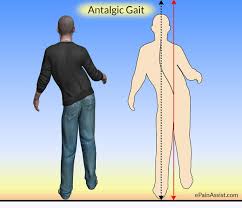Pin On Gout Causes