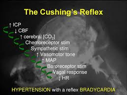 Image result for Cushing Response