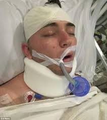 Australian tourist returns home after Bali motorbike crash