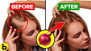 Vitamin a is often overlooked as a vitamin for hair growth and thickness. 15 Natural Solutions To Promote Hair Growth And Thickness Youtube