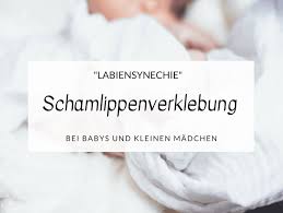 Kleine schamlippen sind aus bindegewebe ohne fettgewebe aufgebaut, enthalten eine große anzahl von elastischen fasern, glatten muskelzellen und venenplexus. Scheide Beim Baby Zugewachsen Schamlippenverklebung How I Met My Momlife