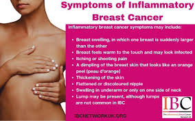 Image result for Inflammatory breast cancer