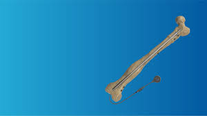 Image result for Orthopichonia