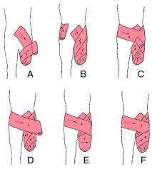 Syme S Amputation Medical Dictionary Subcutaneous Tissue Lower Limb