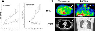 If you're taking a medication to help regulate your blood pressure, you're obviously at least mildly interested in maintaining good health, so it's one heck of a sad coincidence that a whole bunch of blood pressure pills are now being recalled because they might actually give you cancer instead. Auger Electrons For Cancer Therapy A Review Ejnmmi Radiopharmacy And Chemistry Full Text