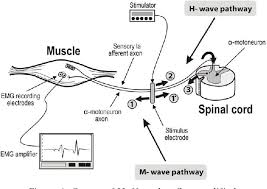 A positive hoffman's reflex may indicate an upper motor neuron lesion or a pyramidal sign. Pdf The H Reflex As An Important Indicator In Kinesiology Semantic Scholar