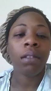 Stroke prevention awareness from a 26 year old patient.