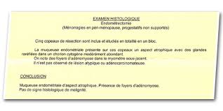 Ursachen der adenomyose symptome einer adenomyose arten der adenomyose grade der adenomyosis diagnose der adenomyose medikamentöse behandlung von adenomyosis. Adenomyose