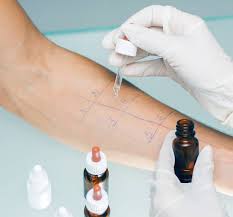 Das macht es so schwer, allergische symptome einem bestimmten lebensmittel zuzuordnen. Prick Allergietest Alle Infos Auf Einen Blick Klarify