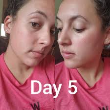 How to incorporate Pomifera's serums into skincare routine