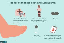 What are the symptoms of type 2 diabetes? The Relationship Between Peripheral Edema And Diabetes