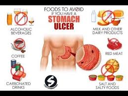 Foods To Avoid If You Have A Stomach Ulcer Stomach Ulcers Food For Stomach Ulcers Stomach Ulcer Diet