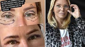 Magdalena graaf, 2 сентября 1975 • 45 лет. Magdalena Graaf Har Opererat Ogonlocken Mycket Piggare Aftonbladet