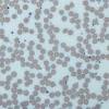 Red blood cells, white blood cells, or platelets. 1