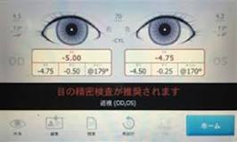 Image result for 小児　眼科　検診