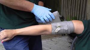 Our israeli bandages are easy and quick to use, with thoughts of your end customers. How To Apply An Emergency Care Israeli Dressing To Control Bleeding Youtube