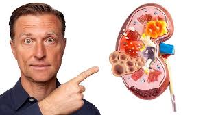 Check out this high protein, kidney friendly, delicious recipe, for  Sardines