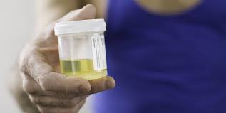 Urine Test Why And How A Urine Test Is Carried Out And What It Can Reveal About Your Health