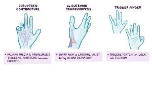 Image result for Normal Anatomic Position of the Hand and Wrist