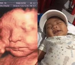 The Baby Ultrasound at Robinsons Place Manila