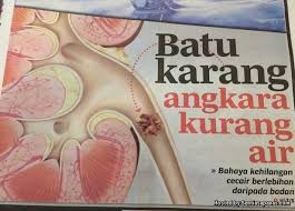 Tanda Tanda Dan Cara Merawat Penyakit Batu Karang Sentiasapanas