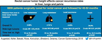 Metastatic cancer that spreads from its original location is known by the name of the primary cancer. The Impact Of Rectal Cancer Tumor Height On Recurrence Rates And Metastatic Location A Competing Risk Analysis Of A National Database Sciencedirect