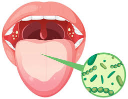 Image result for cancer tongue symptoms)