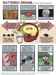 Pin By Vera On Psykologi Head Injury Teaching Psychology Human Body Systems