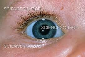 Image result for Sclera
